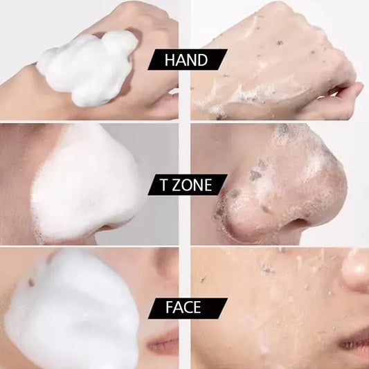 Facial Cleanser Oil Control Shrink Pores Face Wash Foam Face Massasge Facial Hydrating Moisturizing Skin Products Mossee Clean