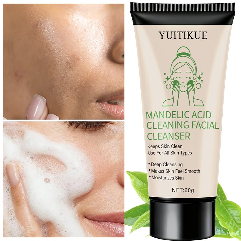 YUITIKUE Facial Cleanser 60g - Mandelic Acid Formula, Gentle Deep Cleansing, Moisturizes & Controls Oil