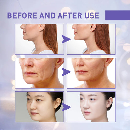 1 set of V-shaped facial lifting patches, lifting and firming the skin, enhancing and tightening facial and chin skincare tools