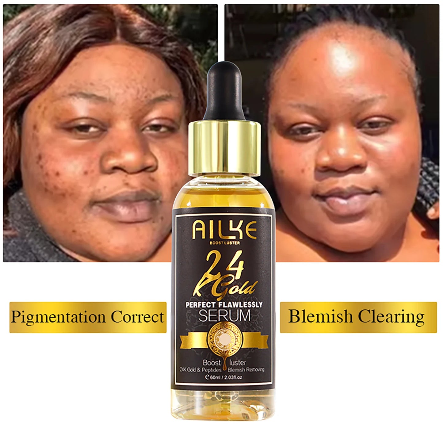 AILKE 24K Gold Collagen Whitening Skin Care Set for All Skin Types, Remove Dark Spot, Wrinkles, Fine lines, Even Skin Tone