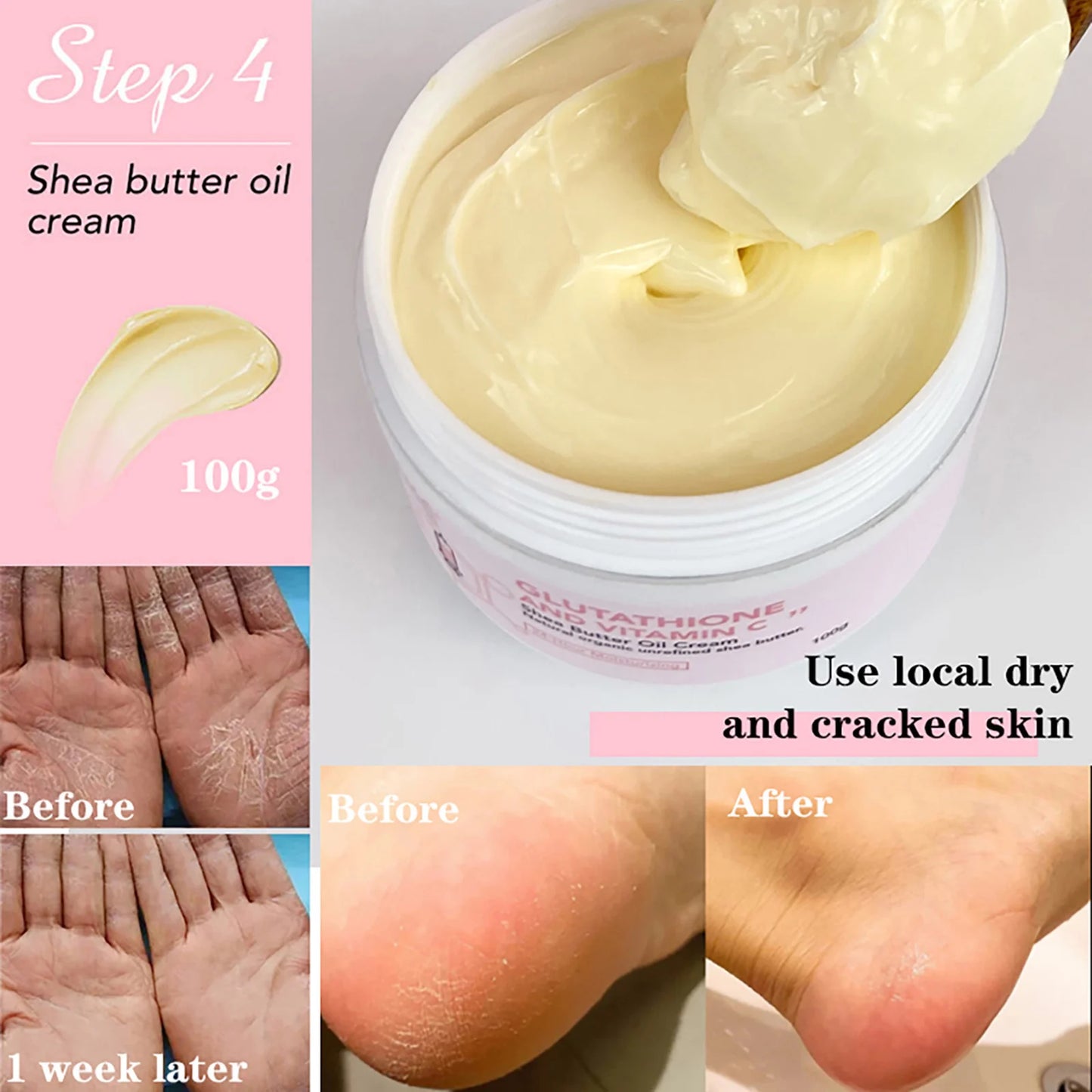 AILKE Skin Whitening Set, With Glutathion, Vitamin C, Shea Butter, Remove Dark Spots, Melanin, Pigmentation, Freckles, Stains