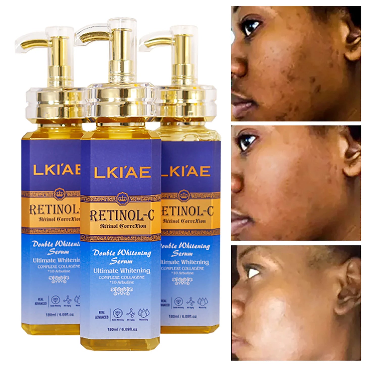 LKIAE Advanced Retinol Whitening Skin Care Set for All Skin Types, Moisturizing, Reduce Wrinkle, Dark Spot, Melanin, Smooth Skin