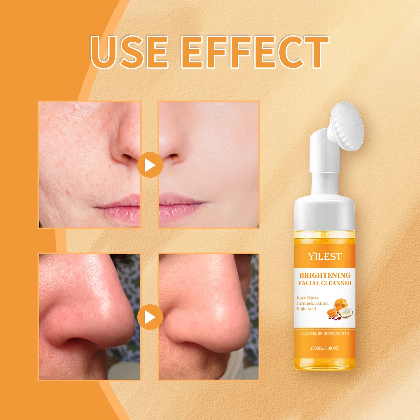 YILEST Brightening Facial Cleanser 100ml - with Kojic Acid, Turmeric & Rose Water, Soft Brush Head for Deep Cleansing, Acne Care